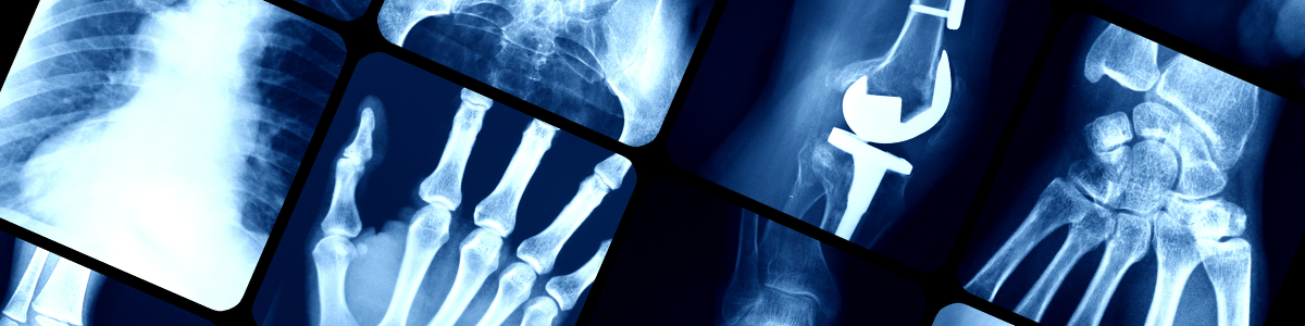 X-Rays | Bayou Bend Health System