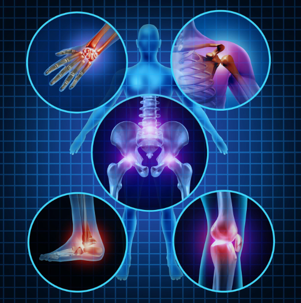 A x-ray of a person 's bones and joints