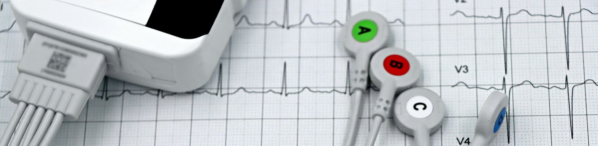 Heart monitor sitting atop a printout of an EKG reading