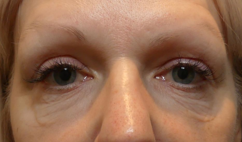 Close-up of a person's eyes, showing eyelids, eyelashes, and slight under-eye bags.