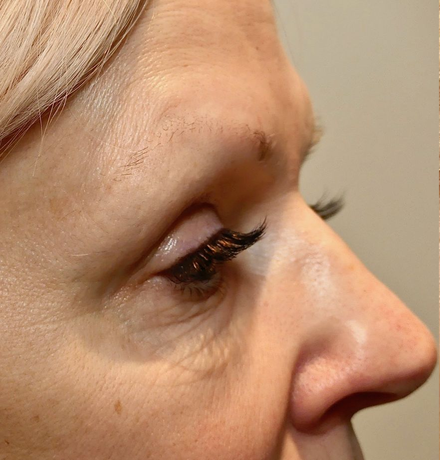 Profile view of a person's face; eye with dark lashes and a nose.