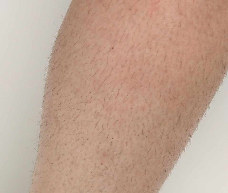 Close-up of a pale human leg covered in fine, dark hair, against a white background.