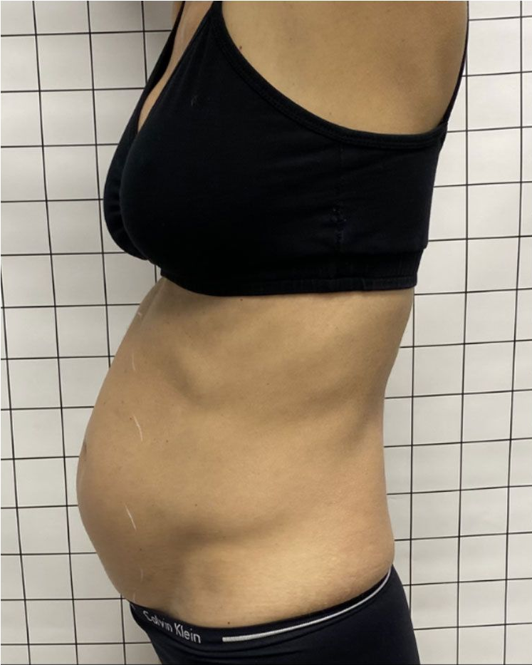 Side view of torso wearing a black sports bra and underwear, with a slightly rounded abdomen against a grid background.