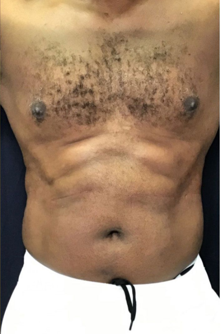 Torso with dark skin and chest hair, visible abs, belly button, and nipples. Wearing white pants.