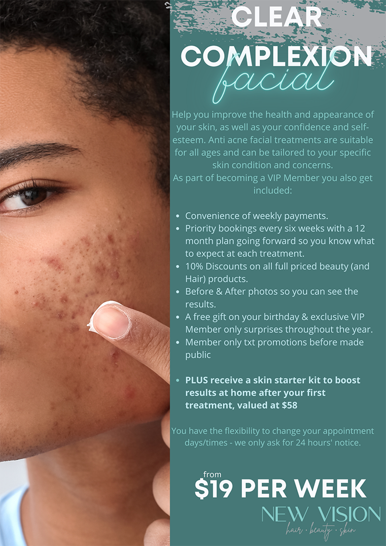 A man with acne on his face is holding his finger to his face.