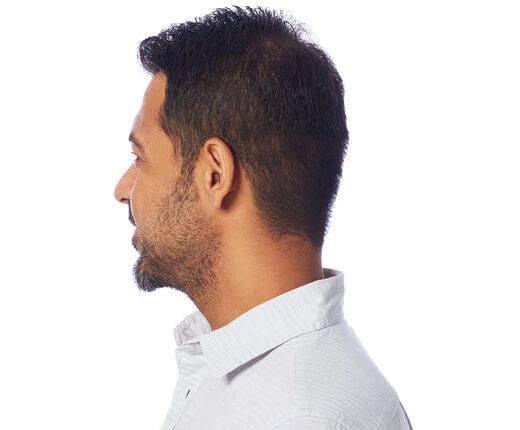Man in a white shirt, viewed from the side, with dark hair and a beard, looking to the left.