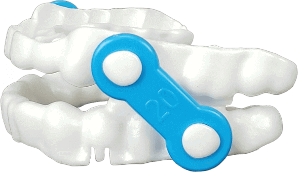 Serena Sleep oral appliance therapy animated image with blue device connecting top and bottom teeth.