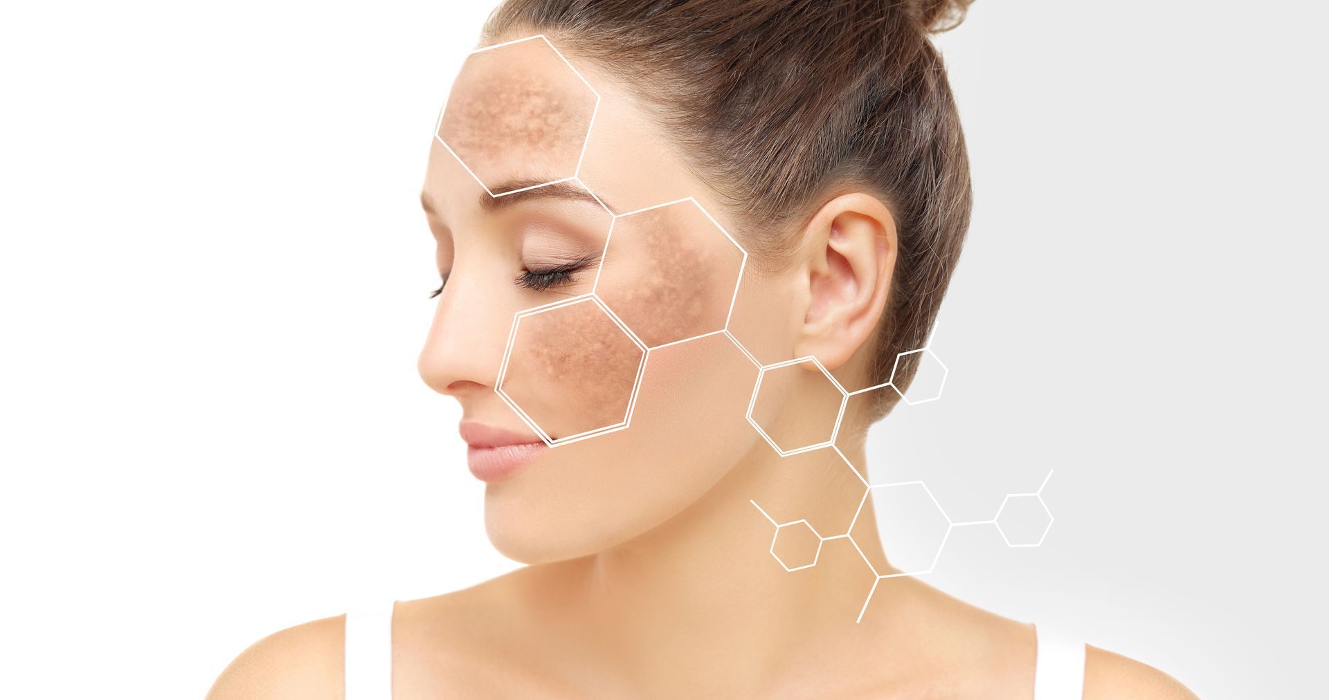 nala-med-spa-vitamin-b12-and-wellness-injections-image