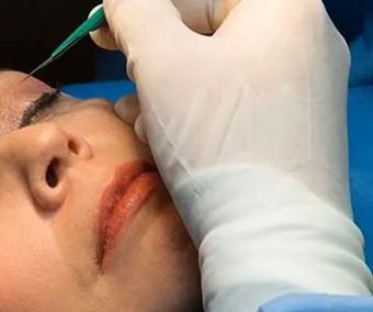 DR. JOAQUÍN CAMACHO LARA - REJUVENECIMIENTO FACIAL