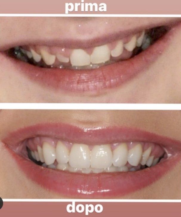 sorriso