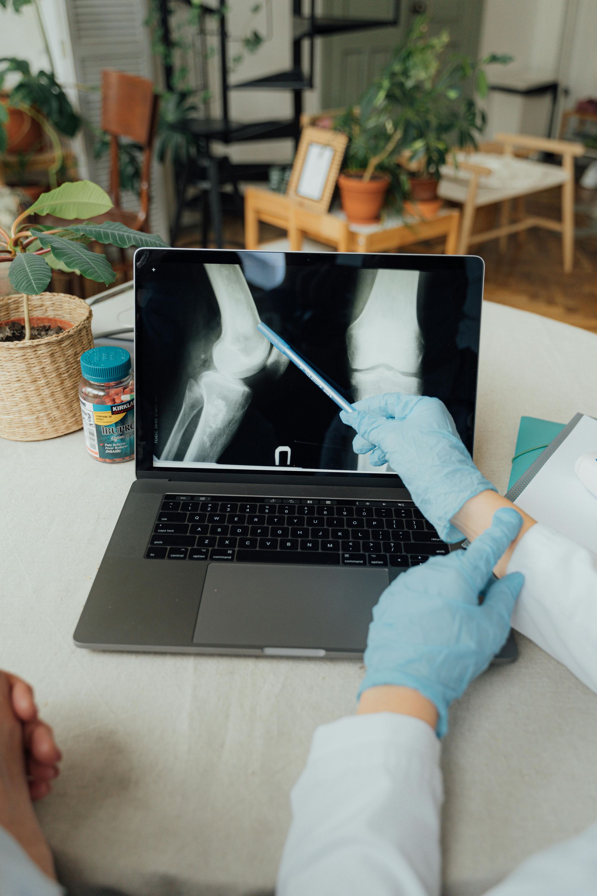 Doctor examining xray of knee