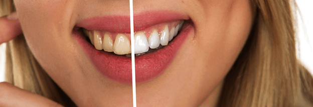 Signs One Need Emergency Dental Care!