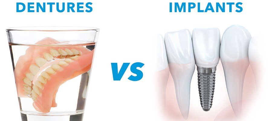 Dentures vs. Dental Implants in California Dentures vs. Dental Implants in California