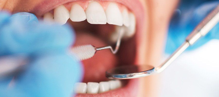 The Ultimate Oral Cancer Prevention Guide: 13 Ways to Reduce Your Risk The Ultimate Oral Cancer Prevention Guide: 13 Ways to Reduce Your Risk