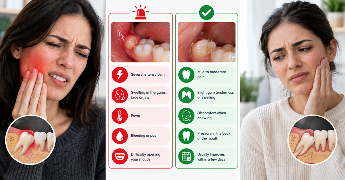 Wisdom Tooth Pain: Emergency Signs vs. Normal Eruption Discomfort