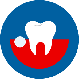 Abscess Tooth Abscess Tooth
