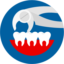 Tooth Extraction