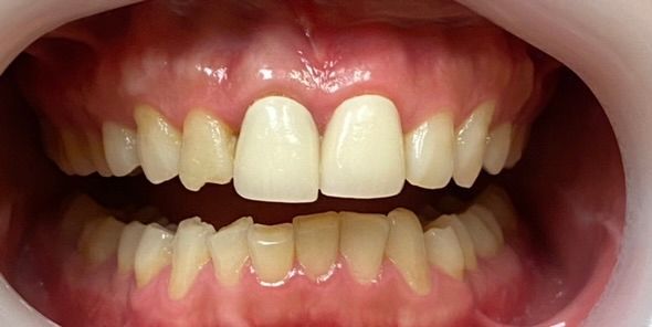 Close-up of a smiling mouth with teeth showing, including a prominent front gap