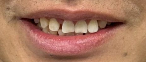 Close-up of a smiling mouth showing teeth and pink lips
