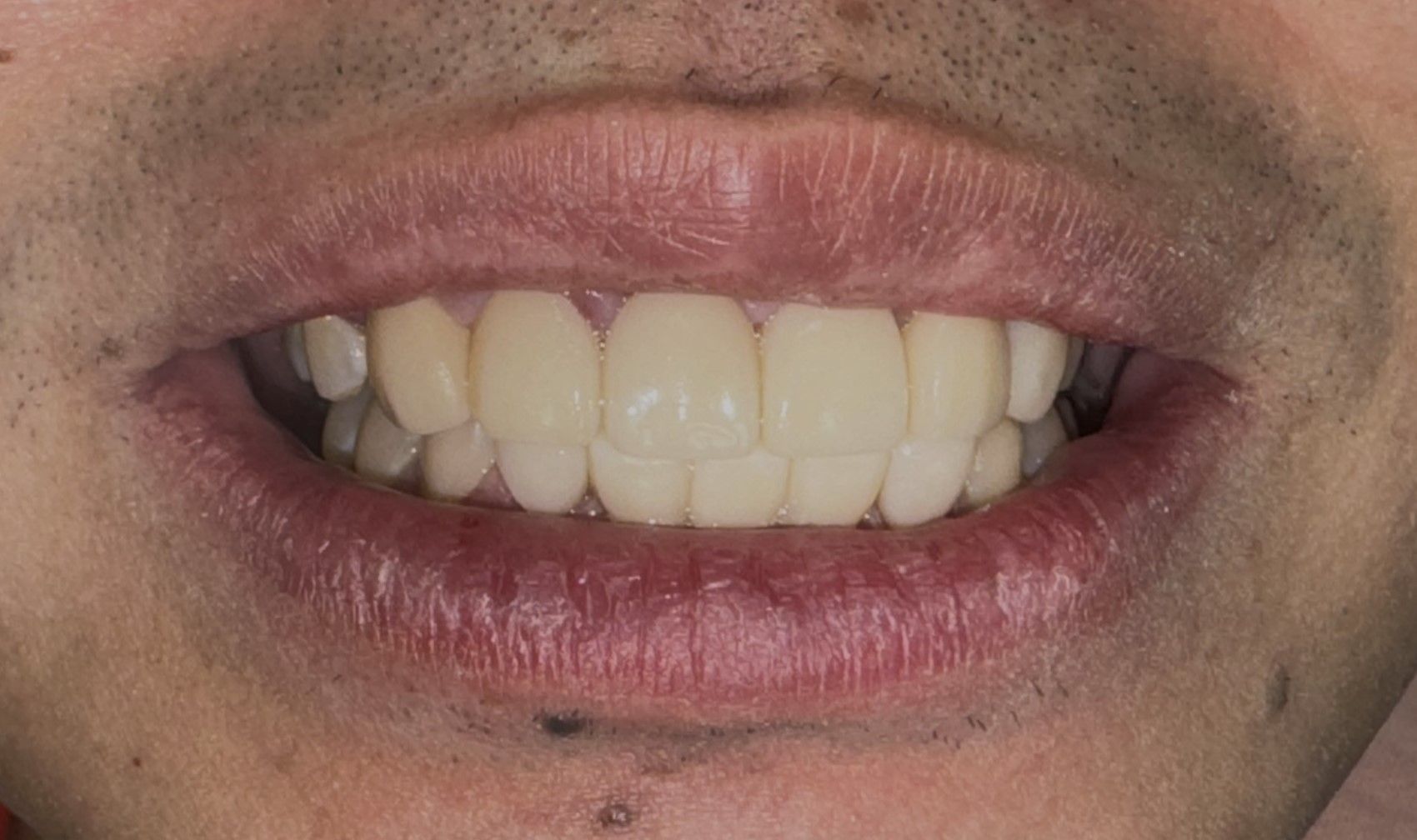 Close-up of a smiling mouth showing teeth and lips