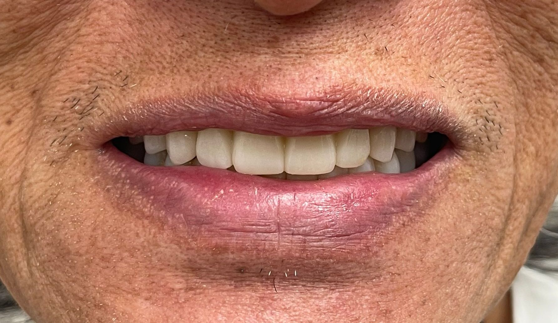 Close-up of a person smiling, showing teeth and lips.