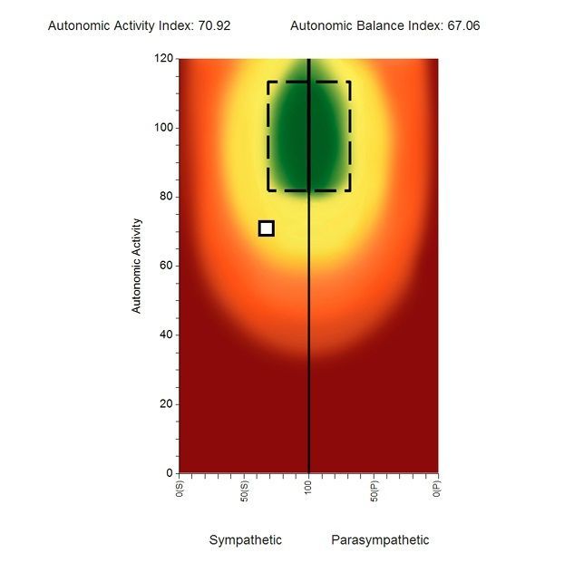 A heart-rate variability scan