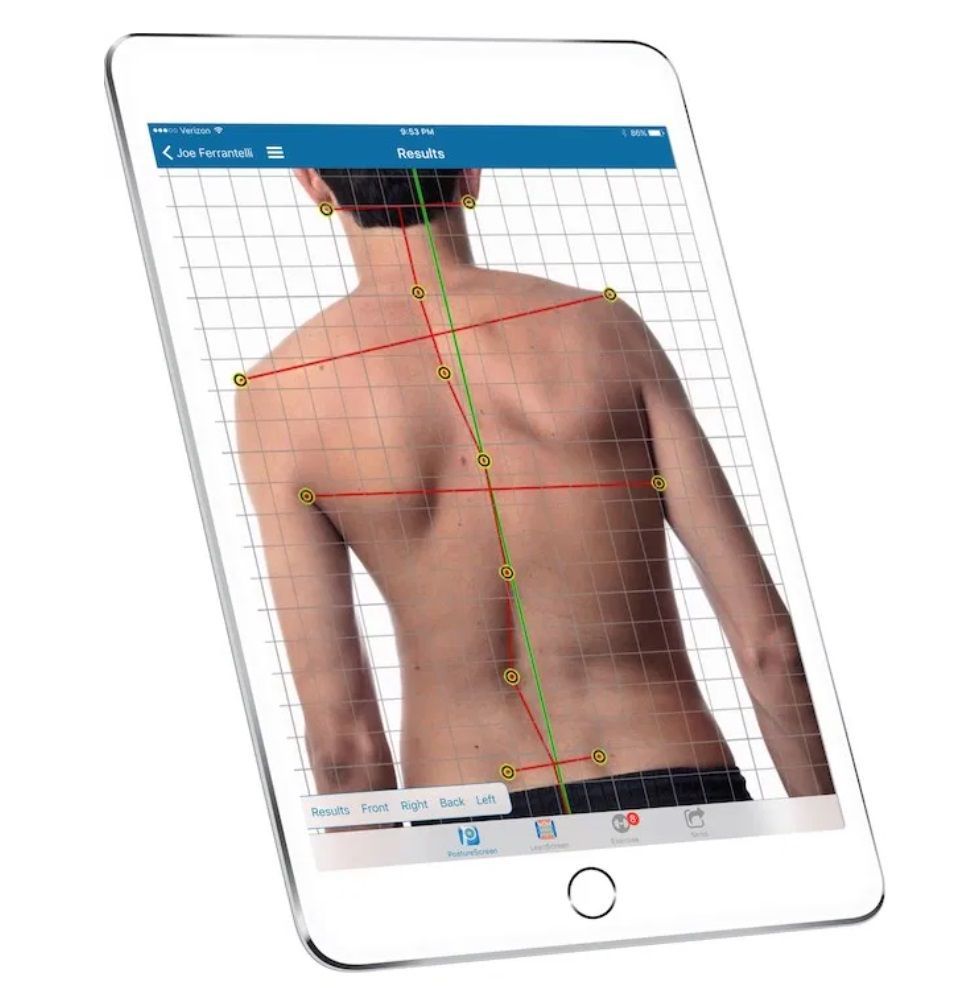 An image of a man's back with lines of postural alignment