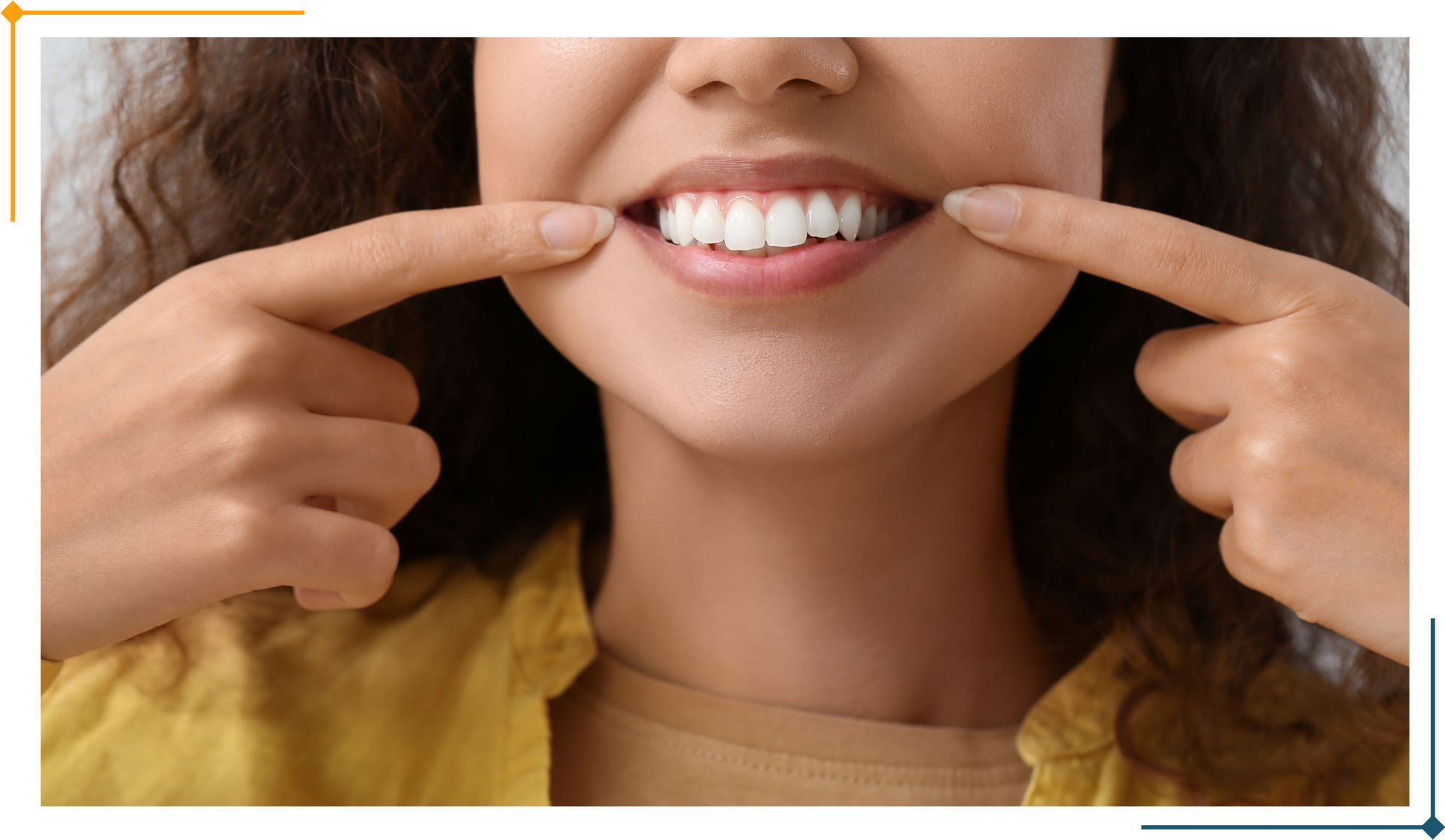Woman pointing to bright white teeth, smiling.