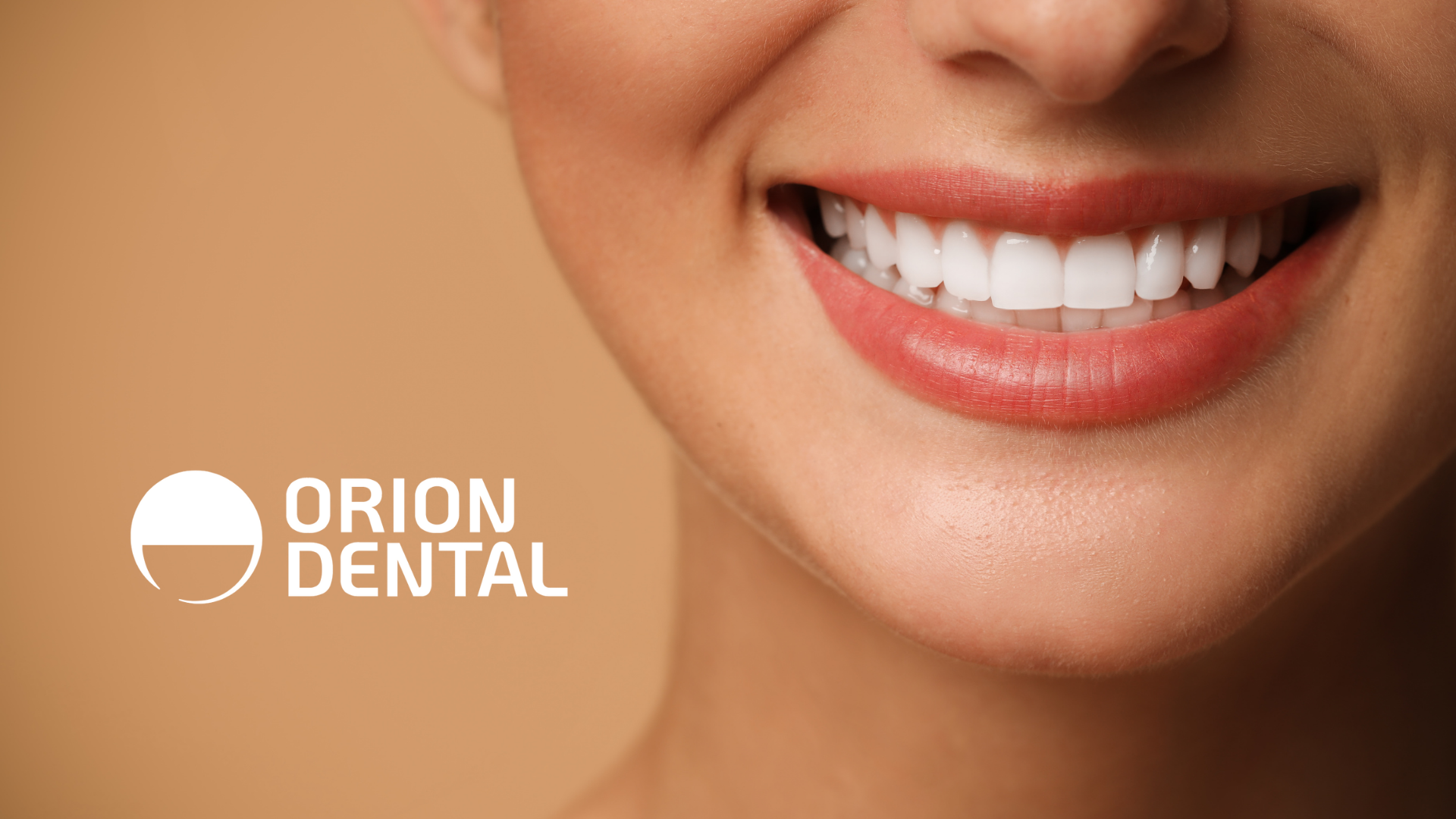 Smiling mouth with bright white teeth; Orion Dental logo in the corner.