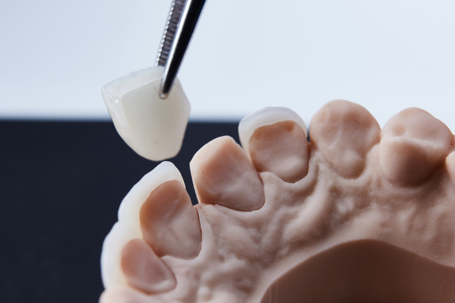 Tweezers holding a porcelain dental veneer above a model of teeth.
