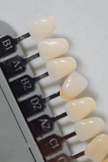 Close-up of a dental shade guide with tooth-shaped samples labeled B1 to C1.