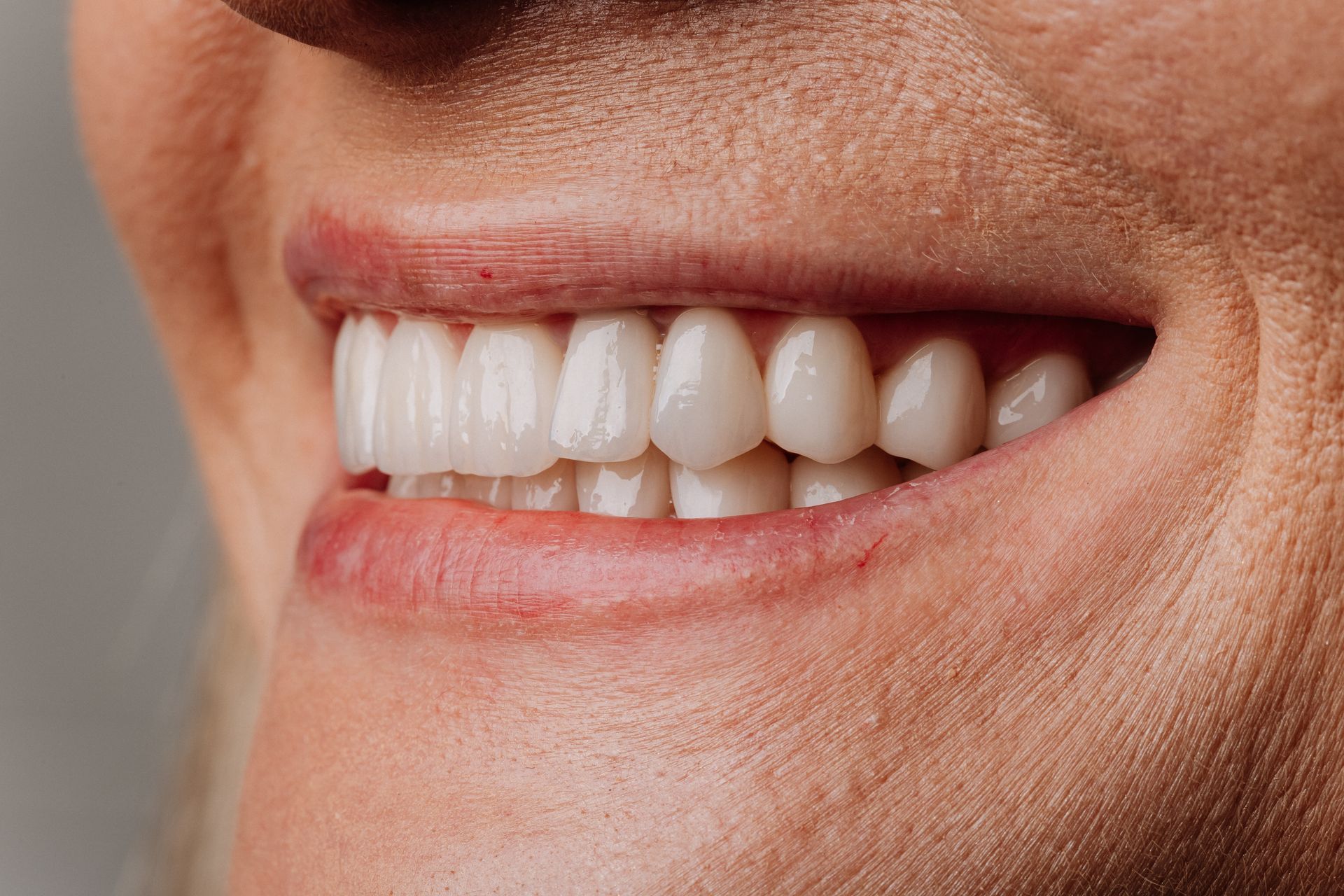 Close-up of a smiling mouth showing white teeth and pink lips