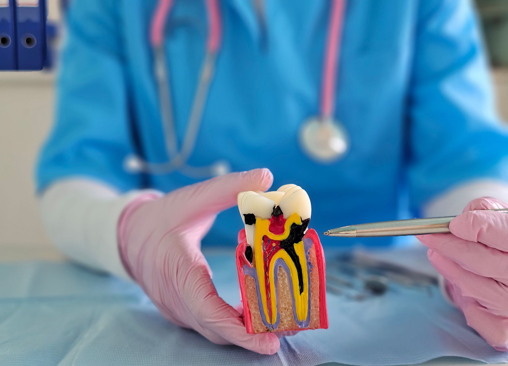 Dentist in gloves holding a cross-section tooth model showing decay and root canals