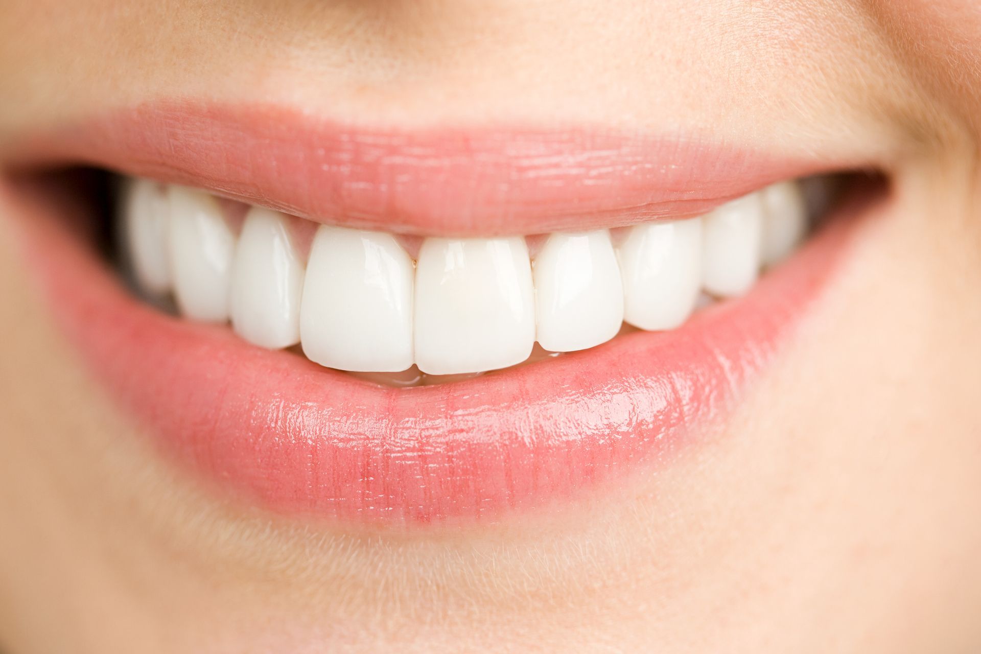 Close-up of a woman's smiling mouth, showing bright white teeth and pink lips.