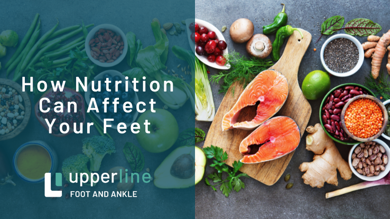 Nutrition and Foot Health Nutrition and Foot Health