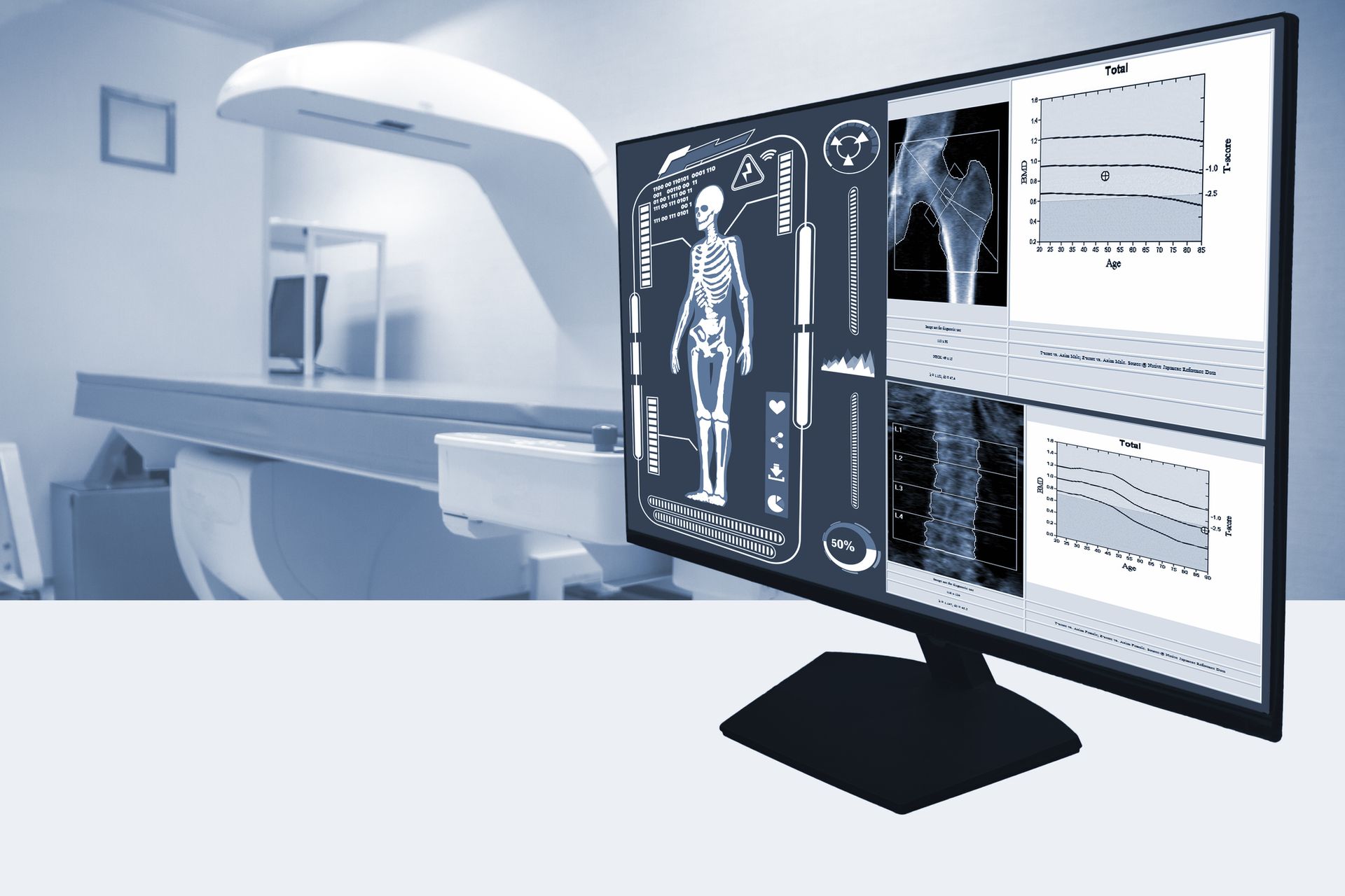 medico per malattie reumatiche a Bari - osteoporosi