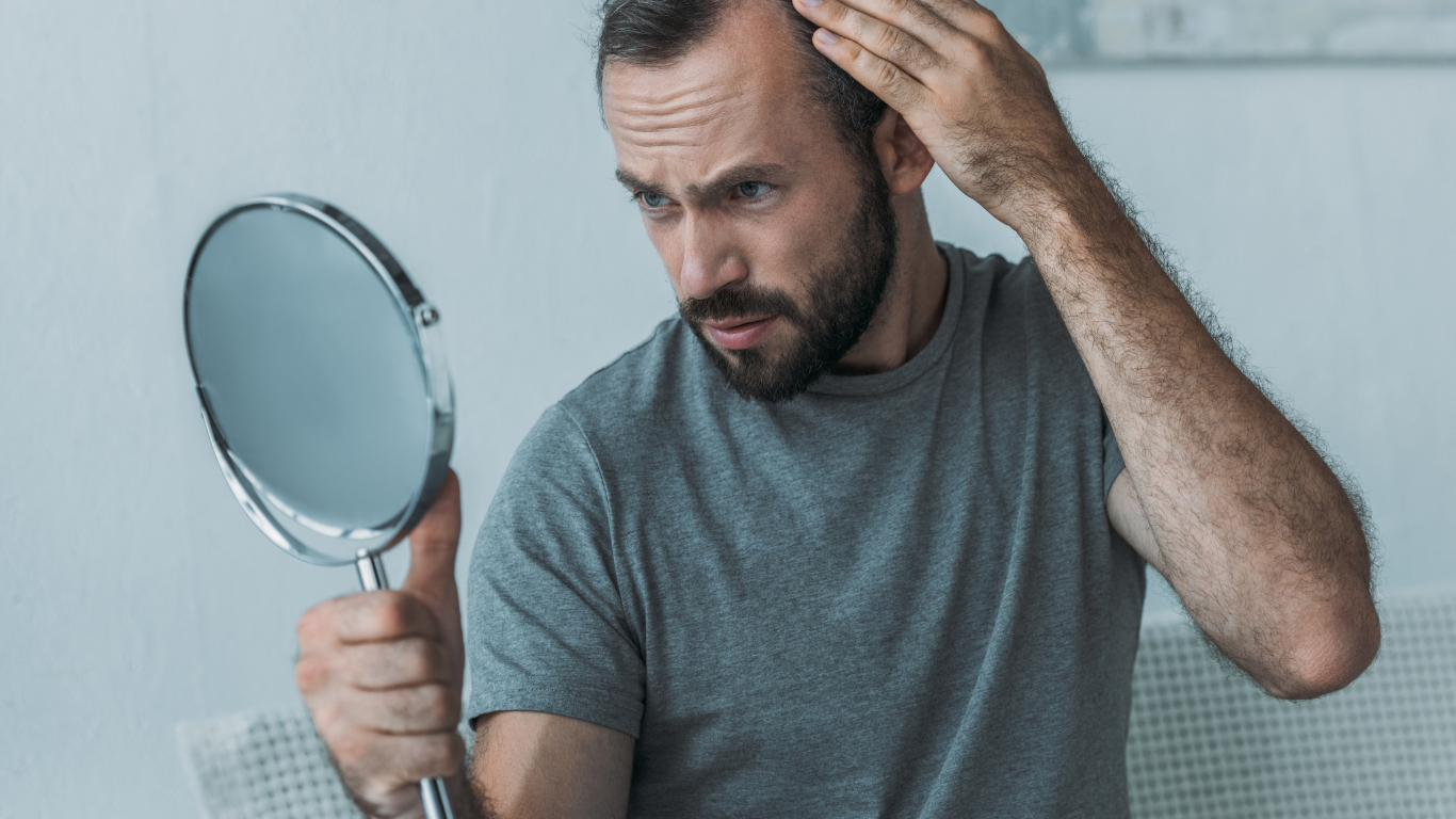 Men's Hair Loss Solutions