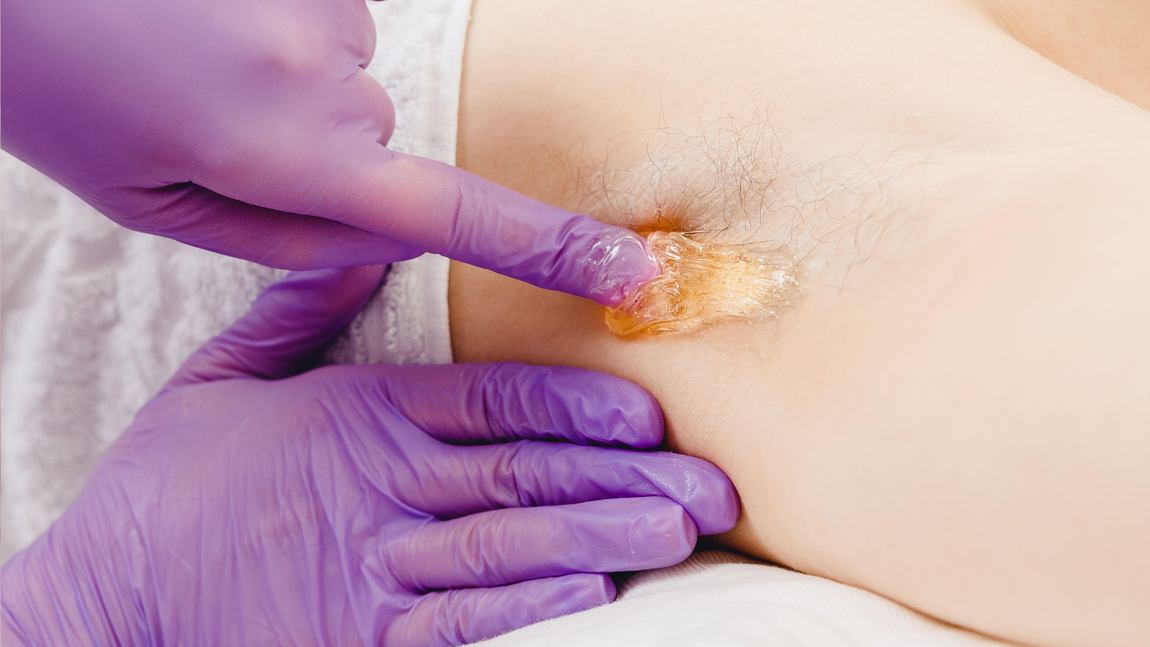 Gloved hands apply ointment to a small wound on a person’s abdomen