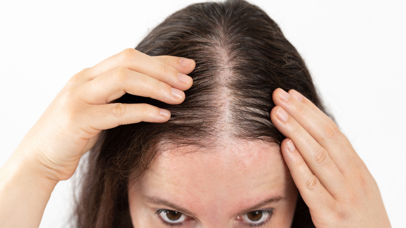 Person parting hair to show scalp on top of head