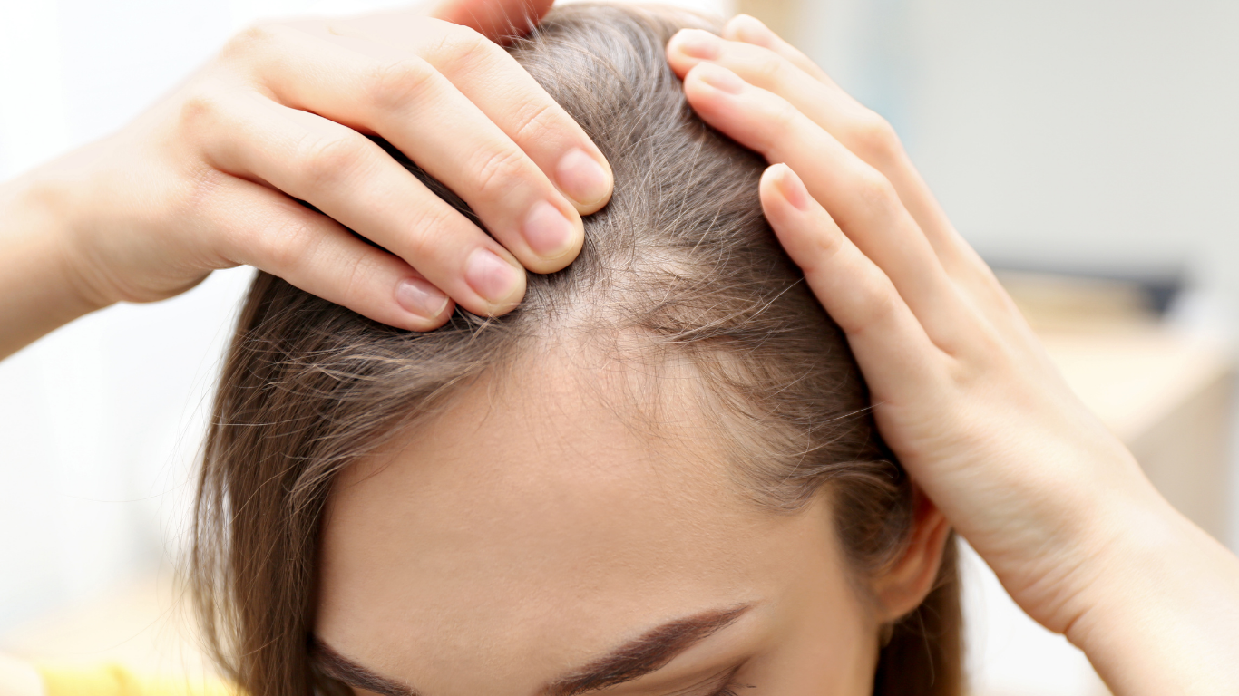 Person holding hands on scalp, examining thinning hair near the part line