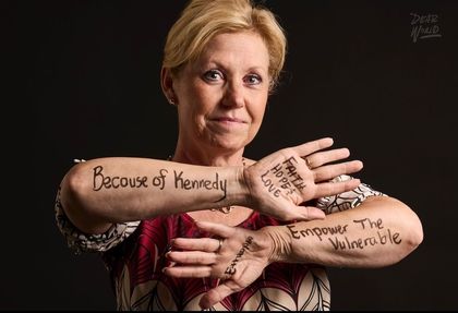 Woman with handwritten messages on her arms, facing forward against a dark background.