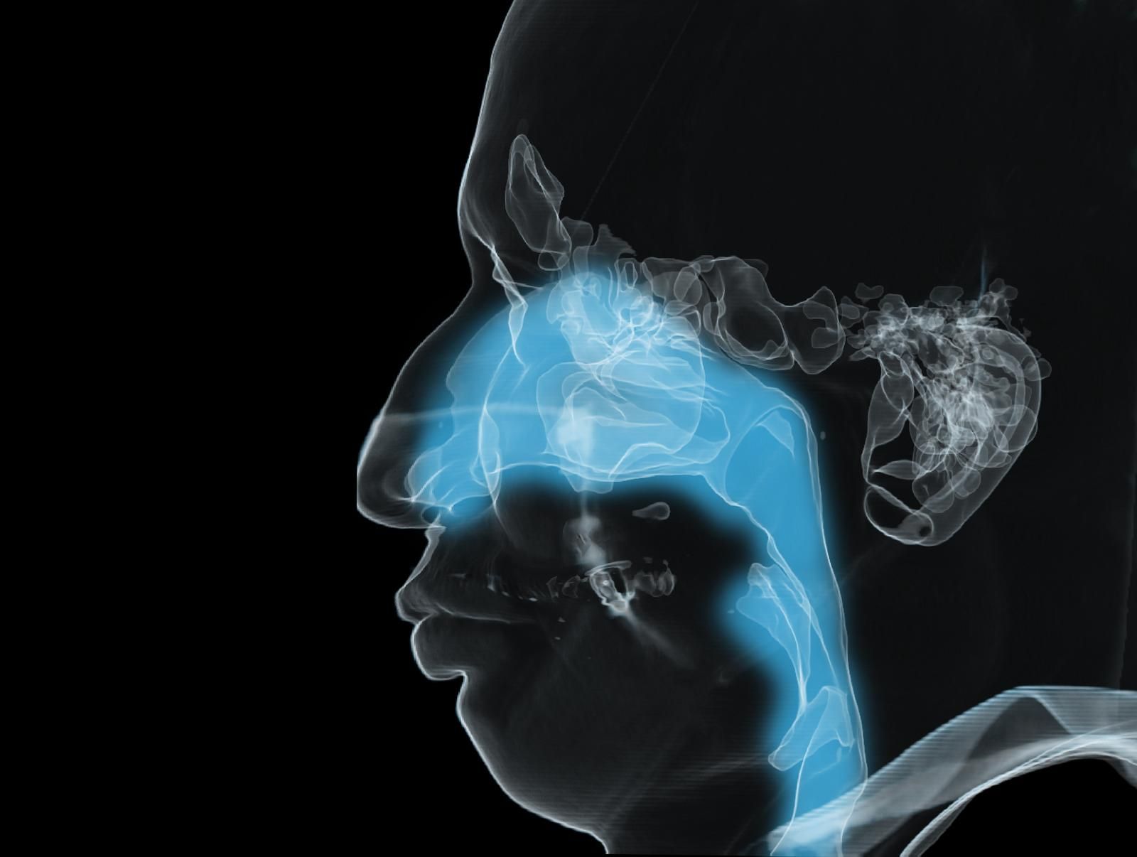 anatomy-of-paranasal-sinuses-and-trachea-airway-3d-illustration
