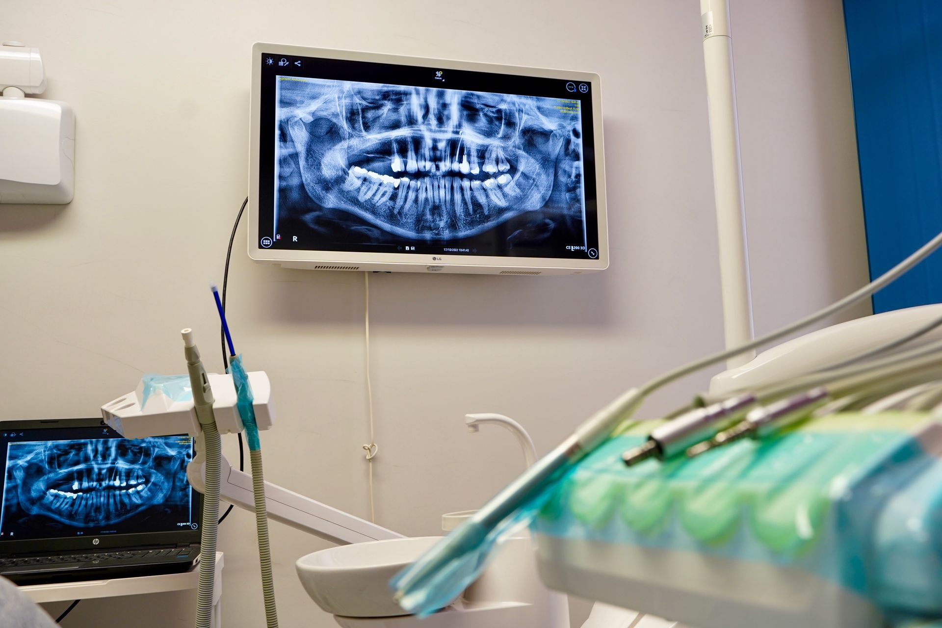 Studio dentistico con radiografie digitali visualizzate su un monitor e un computer portatile, e strumenti odontoiatrici in primo piano.