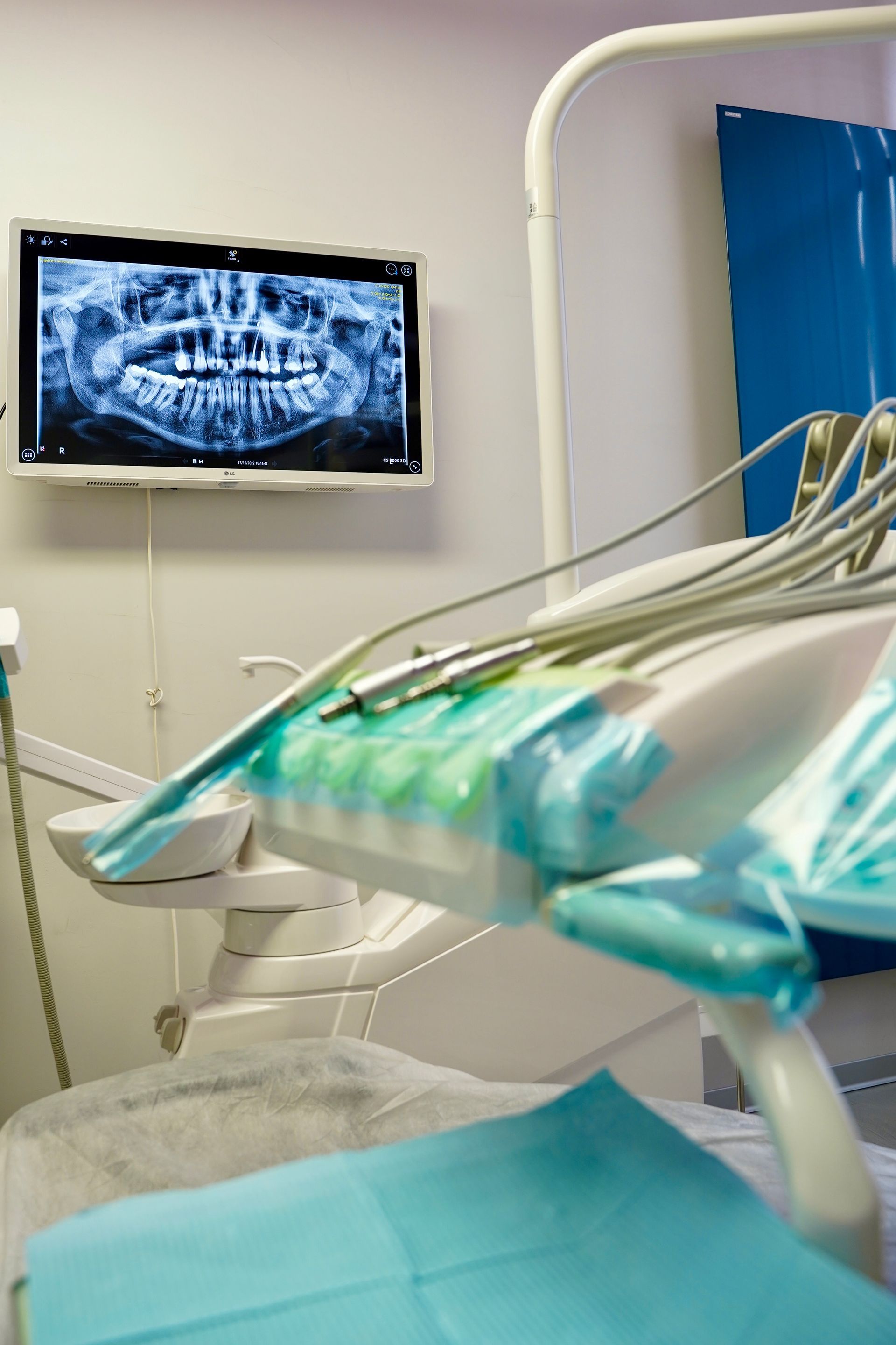 Interno dello studio dentistico con poltrona, attrezzatura e radiografia panoramica visualizzata su un monitor.