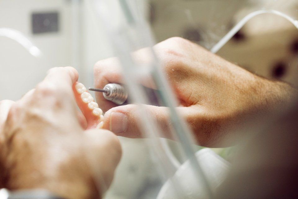 Mani che utilizzano un trapano dentistico per lavorare su una serie di protesi dentarie.