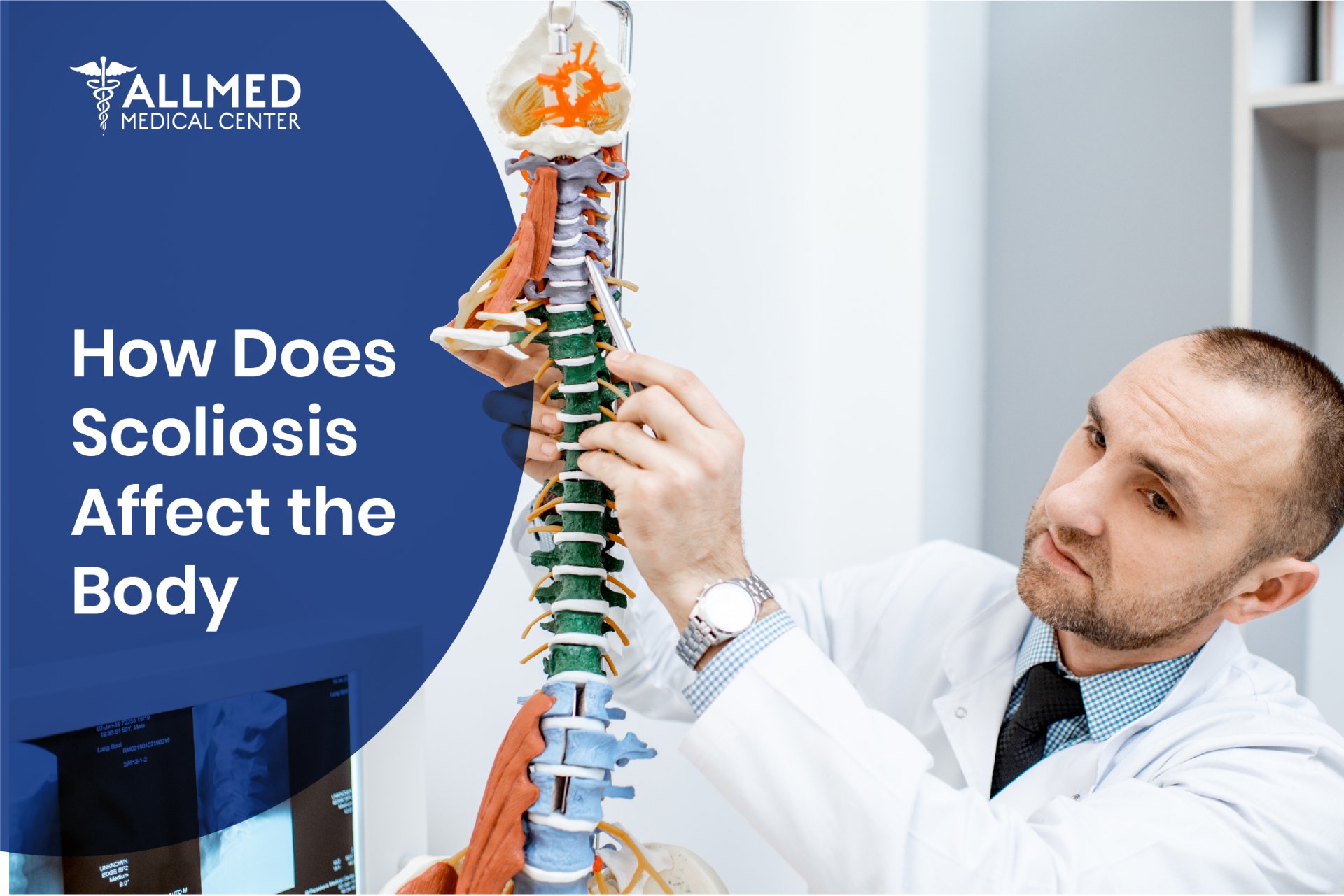 How Scoliosis Affects the Body? AllMed Medical Center