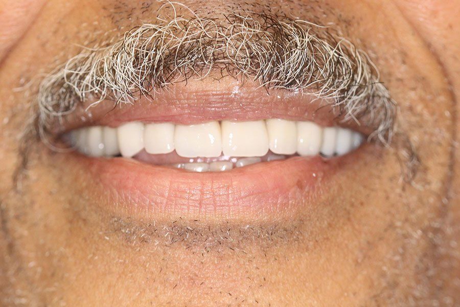 Close-up of a smiling mouth with a mustache and visible teeth