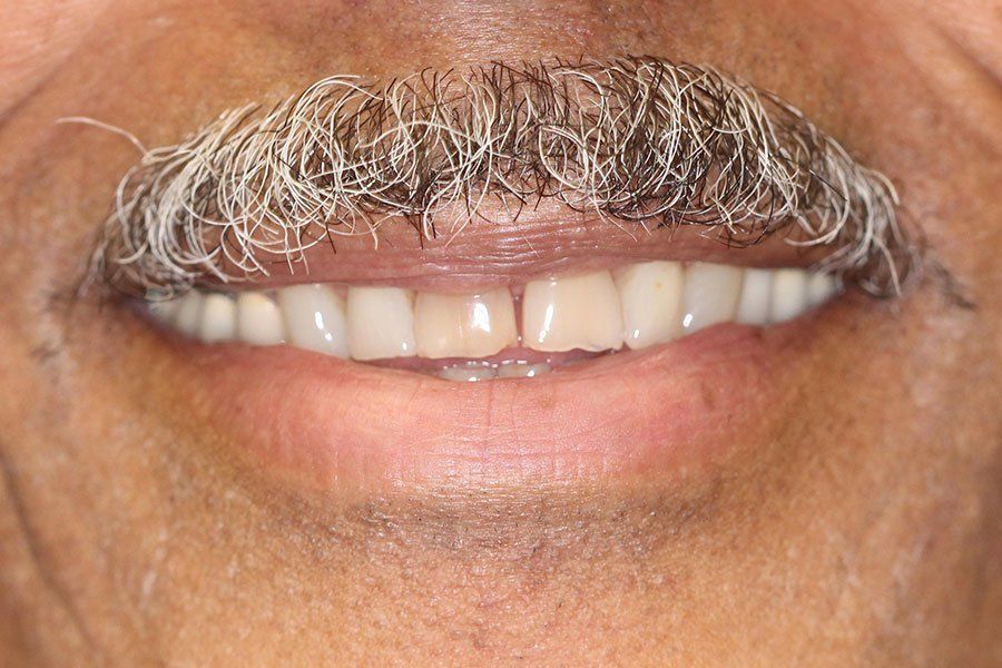 Close-up of a smiling mouth with a gray mustache and visible teeth