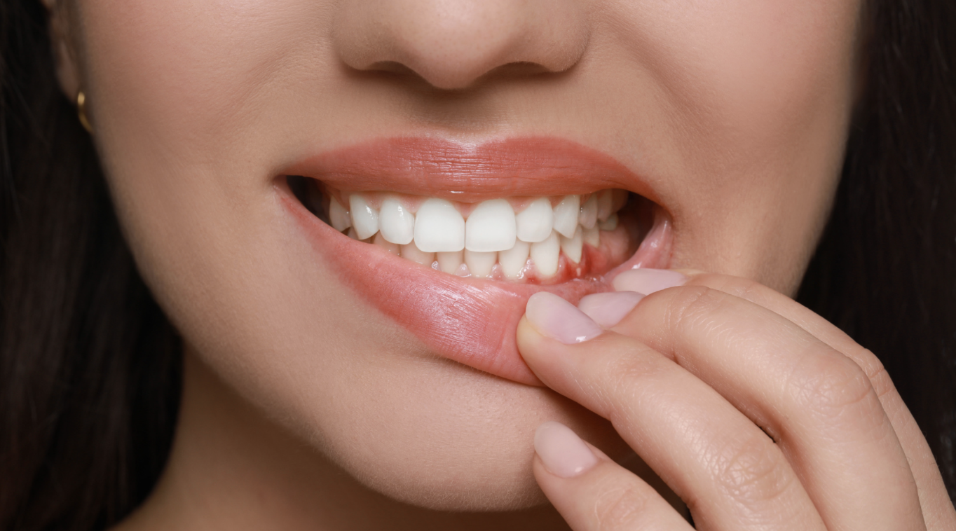 Close-up of a person having bleeding gums