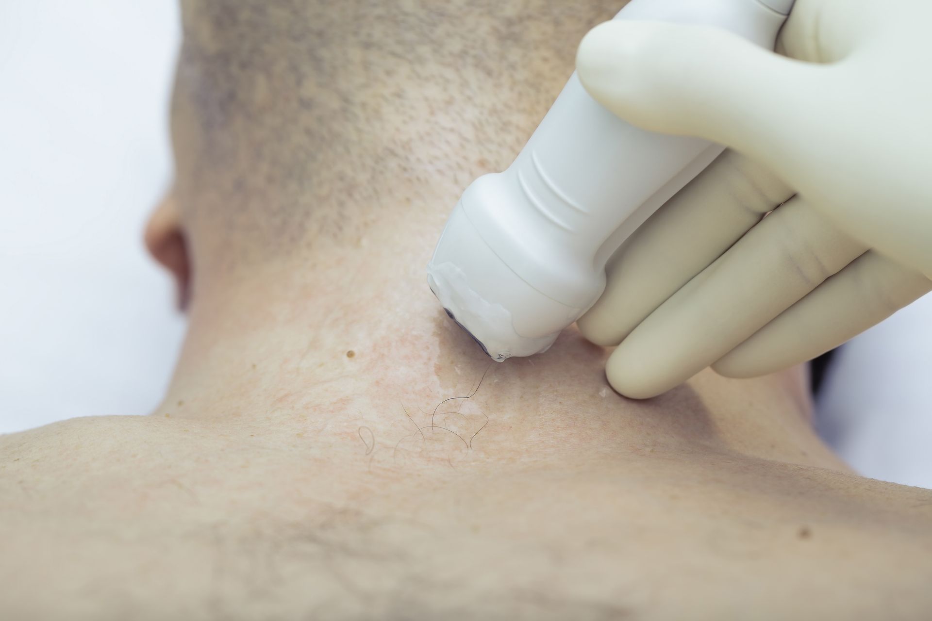 Gloved hand applying a handheld device to the back of a person’s neck
